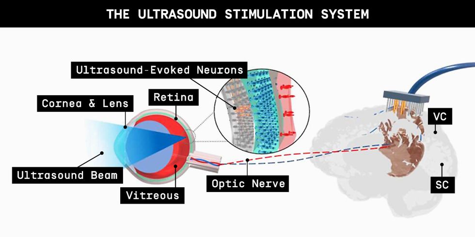 New Prosthetic Retinal Devices: A Hopeful Future for Vision Restoration - ShadeSaint